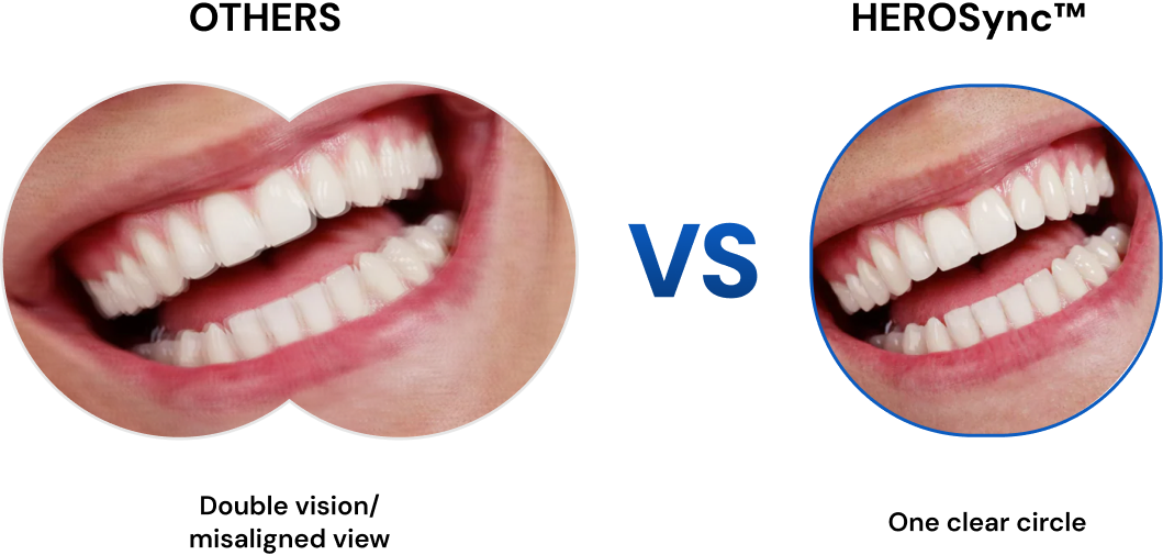 OTHERS vs HEROSync™ vision comparison