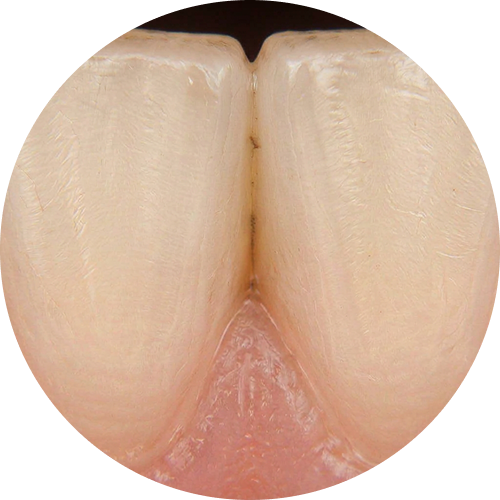 Magnification preview — 10x