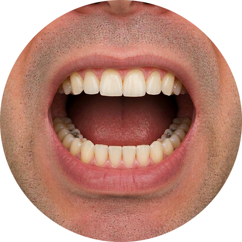 Magnification preview — 3.5x