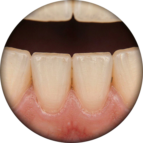 Magnification preview — 8x